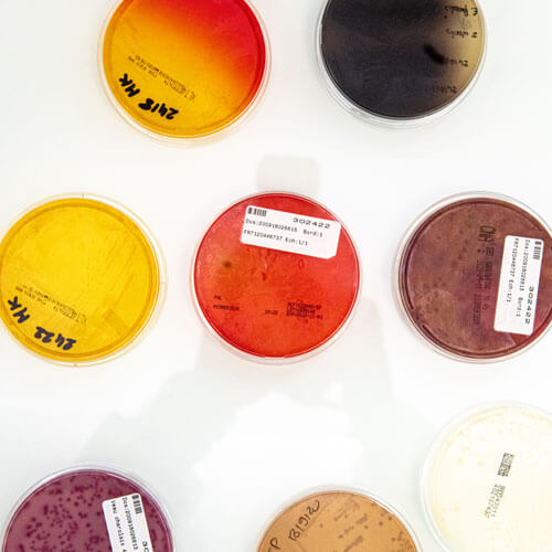 Laboratory analysis agars